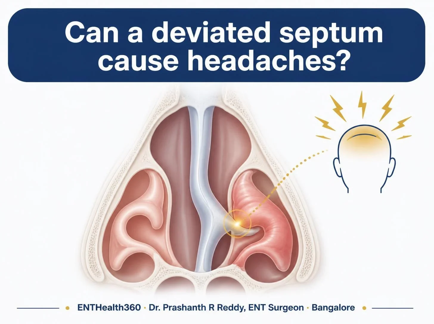 Illustrated cover in ENTHealth360 navy and gold: Can a deviated septum cause headaches?